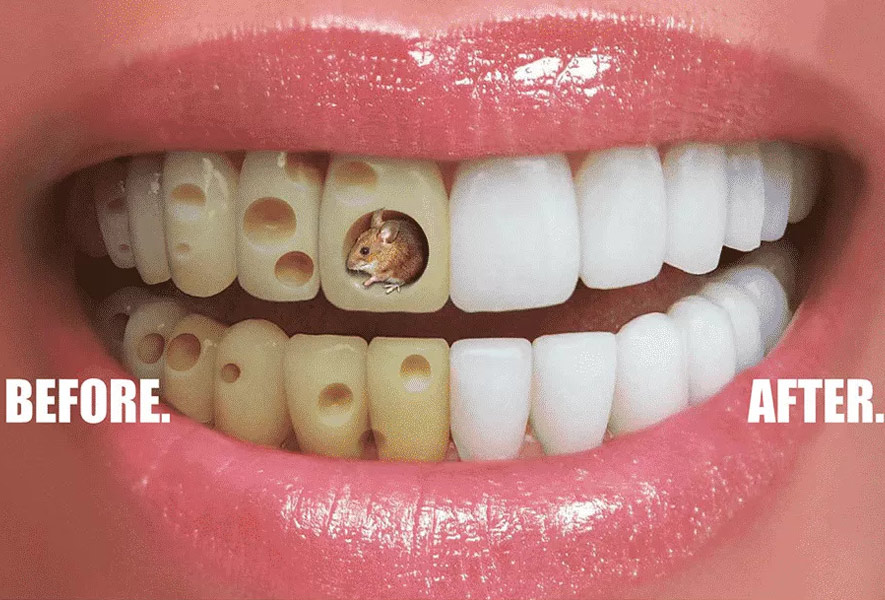 تبلیغات-خلاقانه-پنیر-سوئیسی-برای-مجموعه-عکسهای-قبل-و-بعد-از-دندانپزشکی